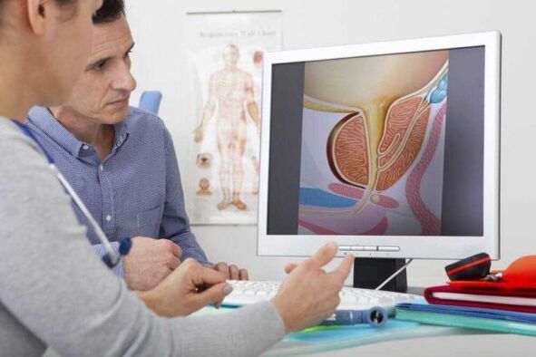 Il medico consulta il paziente sulla questione della prostatite
