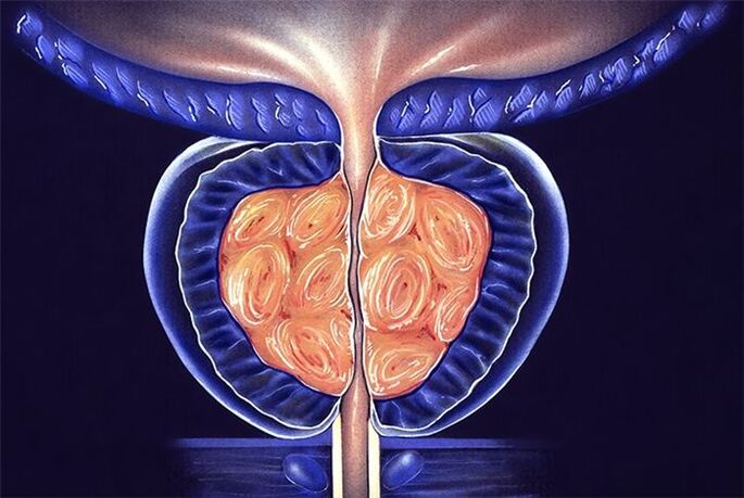 Sintomi e trattamento della prostatite