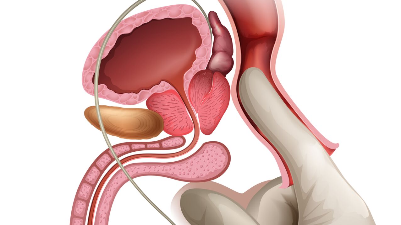 Il massaggio prostatico è un metodo efficace per il trattamento della prostatite congestizia