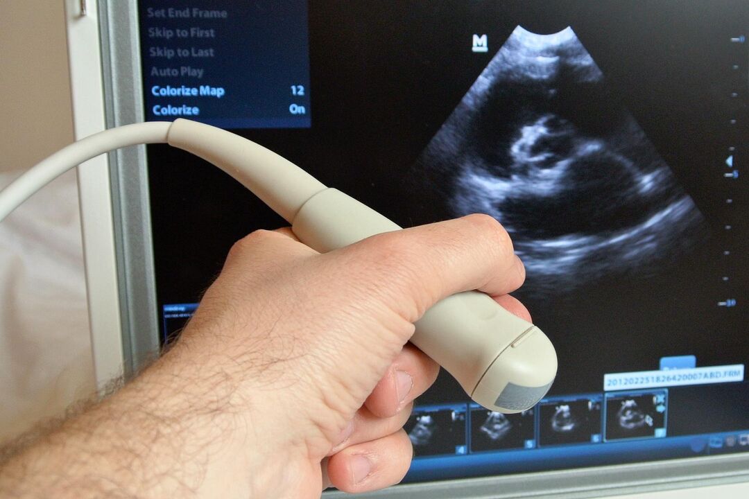 L'ecografia aiuta a diagnosticare la prostatite congestizia in un uomo